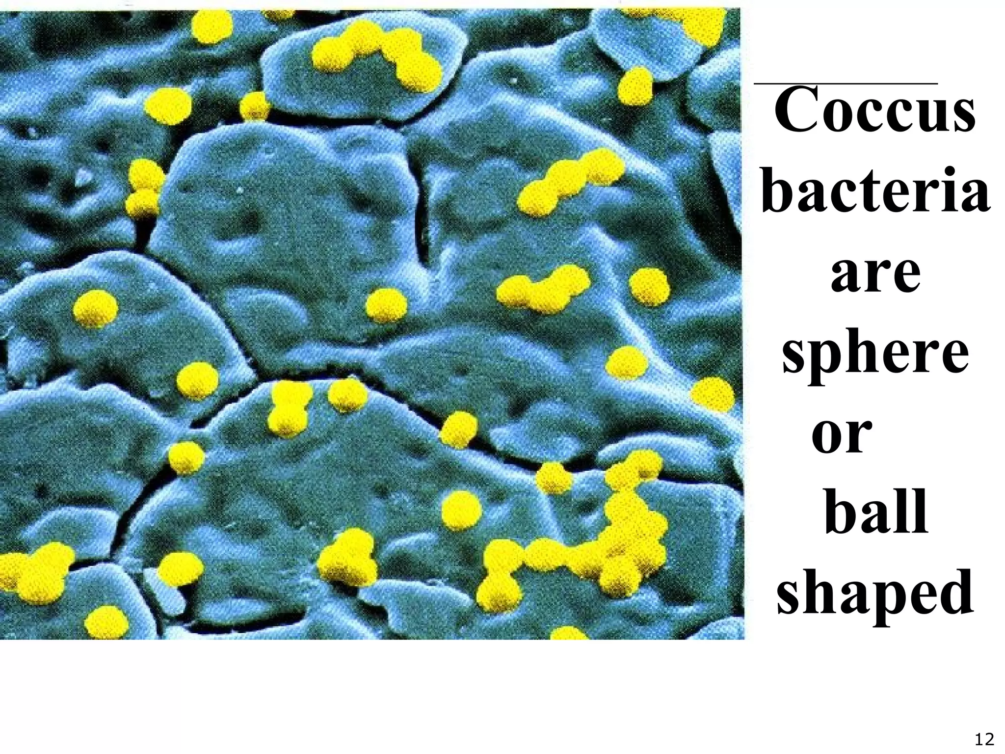 12
Coccus
bacteria
are
sphere
or
ball
shaped
 