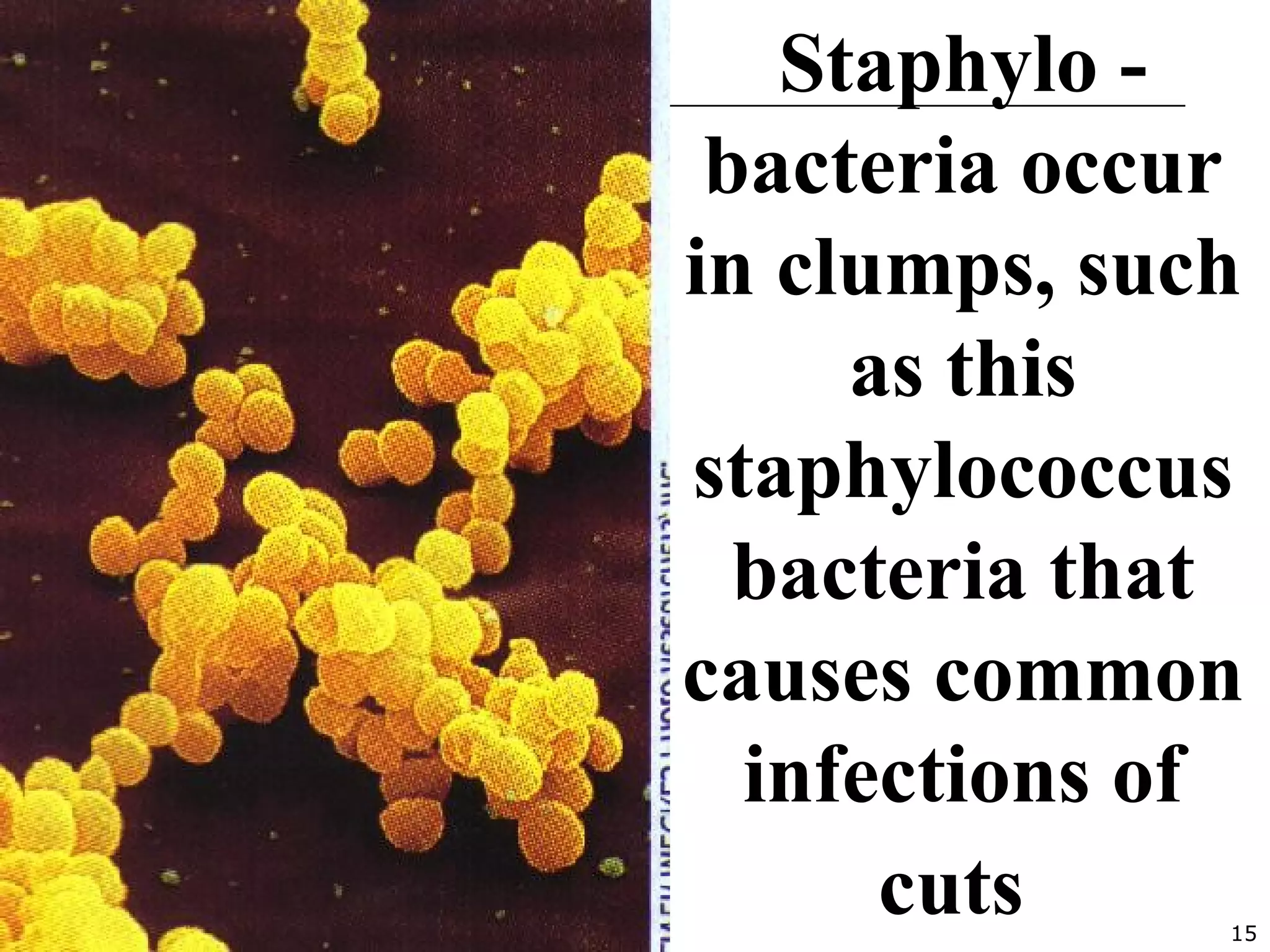 15
Staphylo -
bacteria occur
in clumps, such
as this
staphylococcus
bacteria that
causes common
infections of
cuts
 
