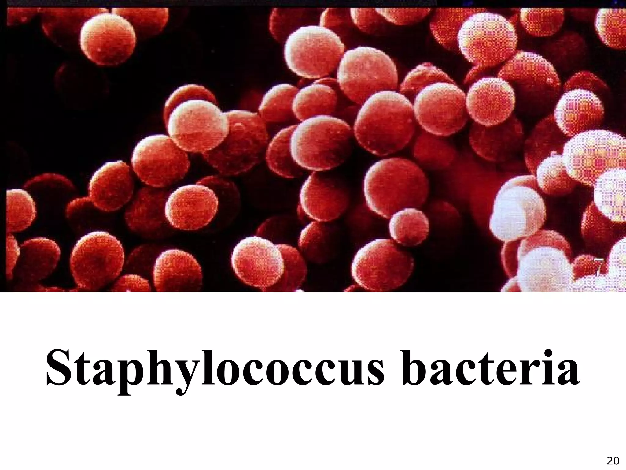 20
Staphylococcus bacteria
 