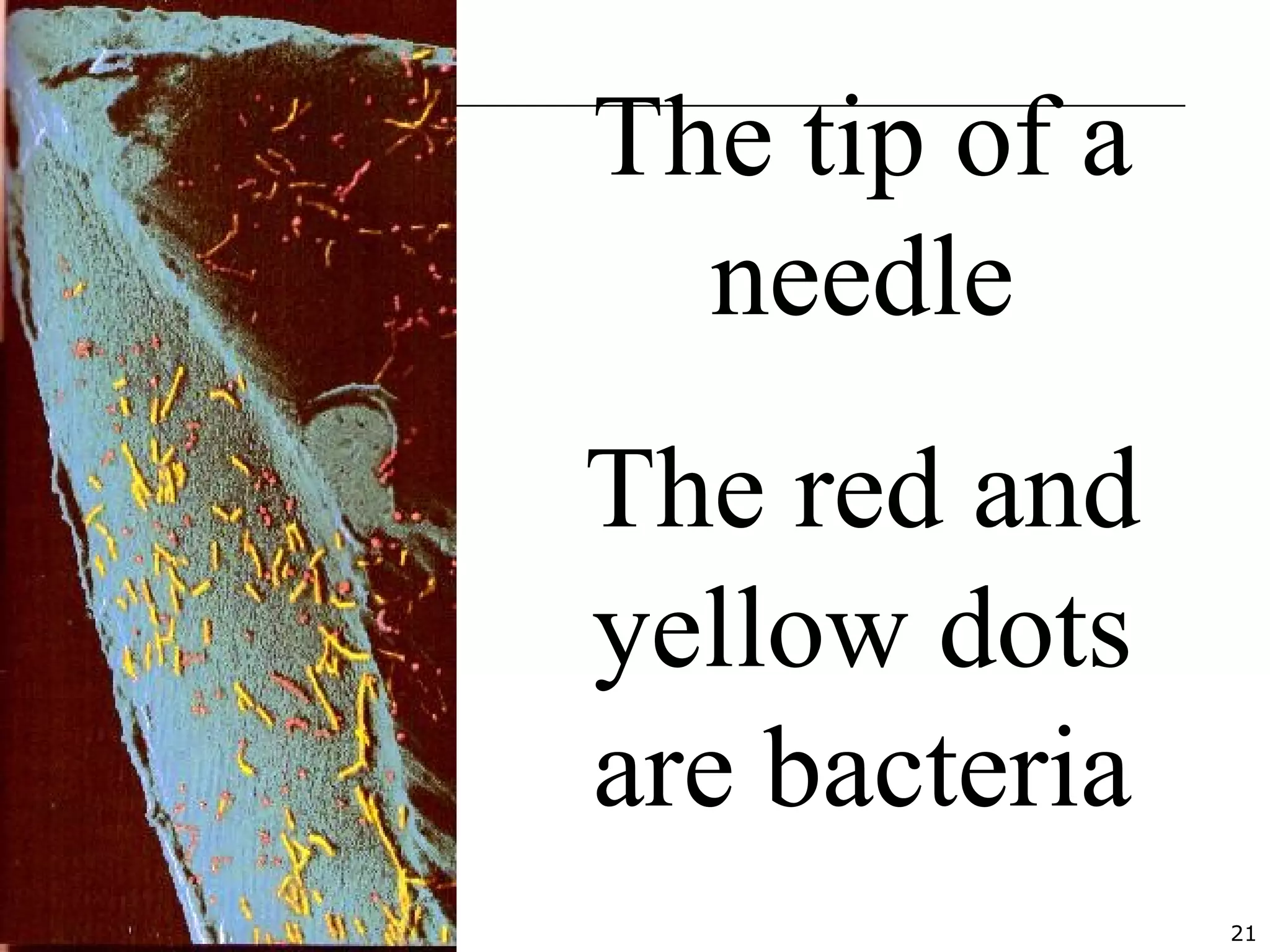 21
The tip of a
needle
The red and
yellow dots
are bacteria
 