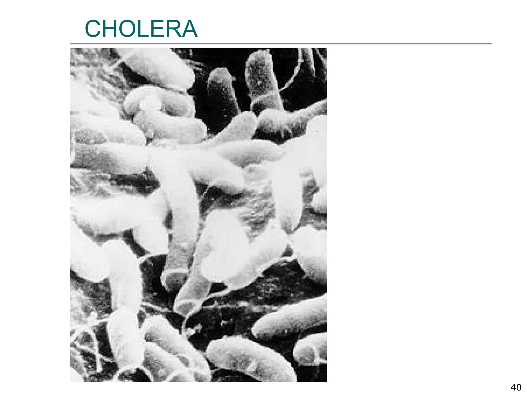 40
CHOLERA
 