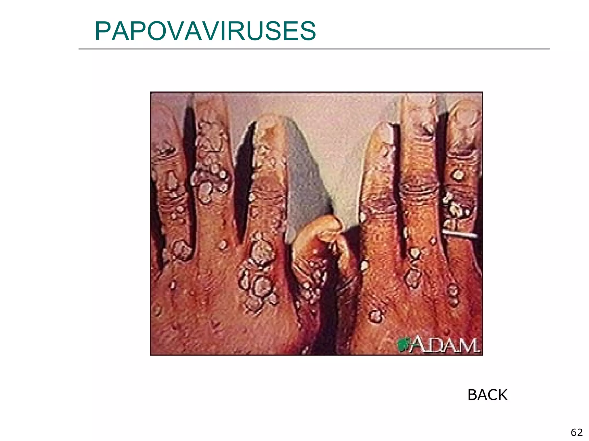 62
PAPOVAVIRUSES
BACK
 