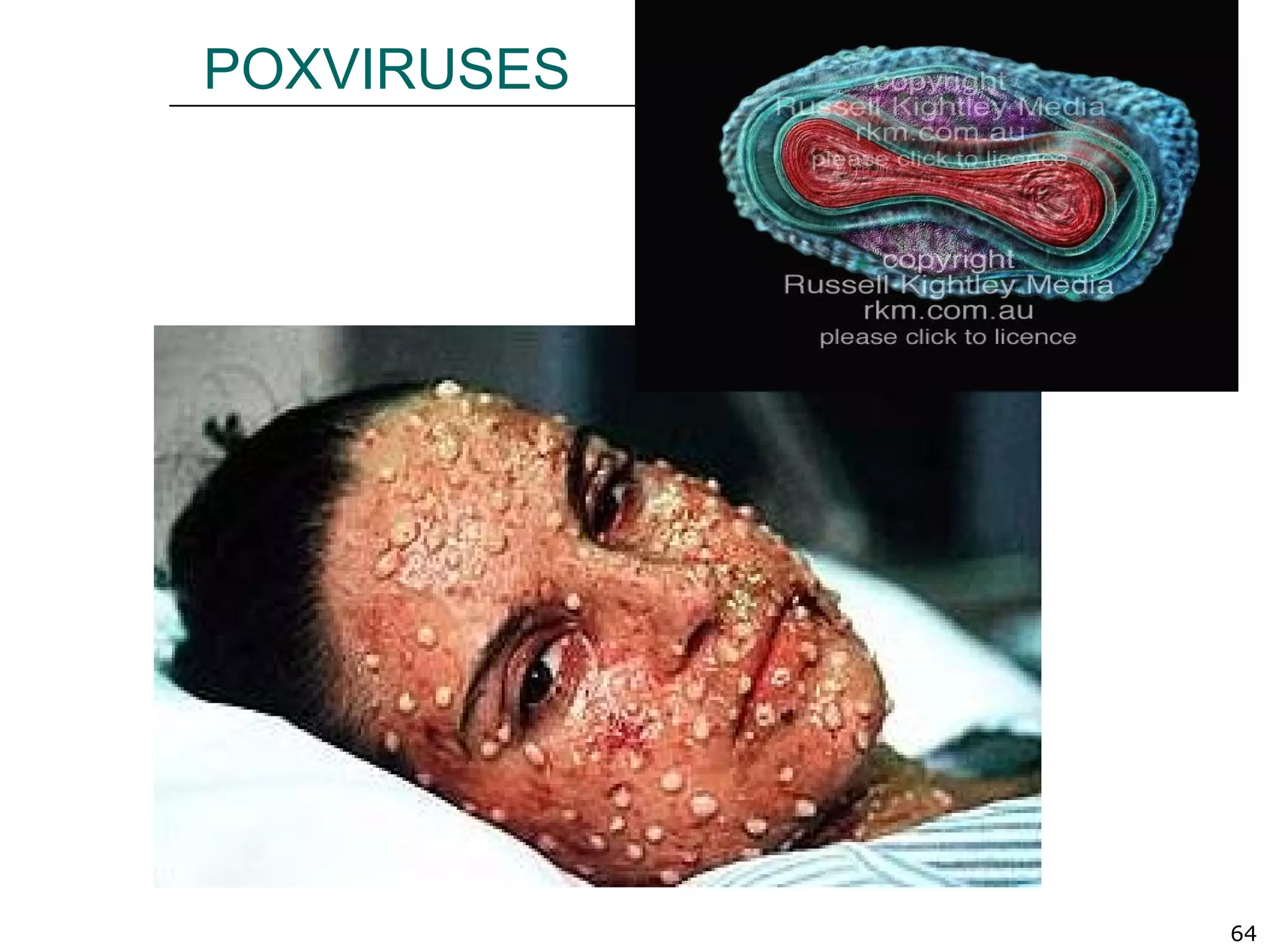 64
POXVIRUSES
 
