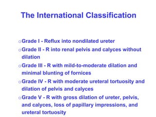 The International Classification
oGrade I - Reflux into nondilated ureter
oGrade II - R into renal pelvis and calyces without
dilation
oGrade III - R with mild-to-moderate dilation and
minimal blunting of fornices
oGrade IV - R with moderate ureteral tortuosity and
dilation of pelvis and calyces
oGrade V - R with gross dilation of ureter, pelvis,
and calyces, loss of papillary impressions, and
ureteral tortuosity
 