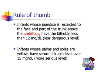 Rule of thumb Infants whose jaundice is restricted to the face and part of the trunk above the  umbilicus , have the bilirubin less than 12 mg/dL (less dangerous level).  Infants whose palms and soles are yellow, have serum bilirubin level over 15 mg/dL (more serious level).  