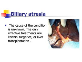 Biliary atresia The cause of the condition is unknown. The only effective treatments are certain surgeries, or liver transplantation . 