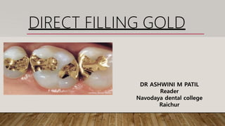 DIRECT FILLING GOLD
DR ASHWINI M PATIL
Reader
Navodaya dental college
Raichur
 