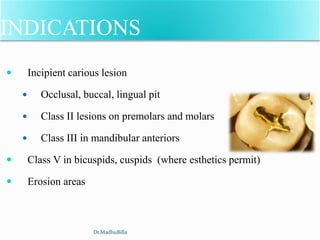 INDICATIONS
 Incipient carious lesion
 Occlusal, buccal, lingual pit
 Class II lesions on premolars and molars
 Class III in mandibular anteriors
 Class V in bicuspids, cuspids (where esthetics permit)
 Erosion areas
Dr.MadhuBilla
 