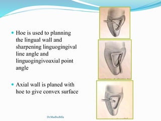  Hoe is used to planning
the lingual wall and
sharpening linguogingival
line angle and
linguogingivoaxial point
angle
 Axial wall is planed with
hoe to give convex surface
Dr.MadhuBilla
 