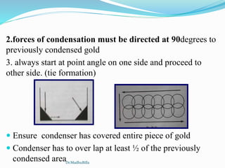 2.forces of condensation must be directed at 90degrees to
previously condensed gold
3. always start at point angle on one side and proceed to
other side. (tie formation)
 Ensure condenser has covered entire piece of gold
 Condenser has to over lap at least ½ of the previously
condensed areaDr.MadhuBilla
 