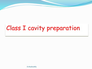 Class I cavity preparation
Dr.MadhuBilla
 