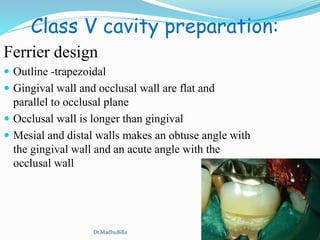 Class V cavity preparation:
Ferrier design
 Outline -trapezoidal
 Gingival wall and occlusal wall are flat and
parallel to occlusal plane
 Occlusal wall is longer than gingival
 Mesial and distal walls makes an obtuse angle with
the gingival wall and an acute angle with the
occlusal wall
Dr.MadhuBilla
 