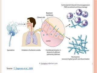 Title : DEEP FUNGAL INFECTIONS AND IT'S TYPES | PPTX