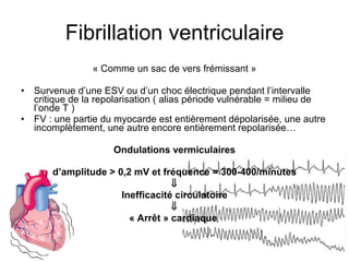 Fibrillation ventriculaire « Comme un sac de vers frémissant » Survenue d’une ESV ou d’un choc électrique pendant l’intervalle critique de la repolarisation ( alias période vulnérable = milieu de l’onde T )  FV : une partie du myocarde est entièrement dépolarisée, une autre incomplètement, une autre encore entièrement repolarisée…  Ondulations vermiculaires d’amplitude > 0,2 mV et fréquence = 300-400/minutes  Inefficacité circulatoire  « Arrêt » cardiaque   