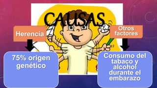 CAUSASHerencia
Otros
factores
75% origen
genético
Consumo del
tabaco y
alcohol
durante el
embarazo
 