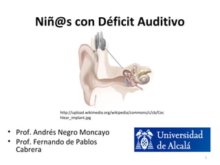 Niñ@s con Déficit Auditivo
1
• Prof. Andrés Negro Moncayo
• Prof. Fernando de Pablos
Cabrera
http://upload.wikimedia.org/wikipedia/commons/c/cb/Coc
hlear_implant.jpg
 