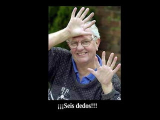 ¡¡¡Seis dedos!!! 
