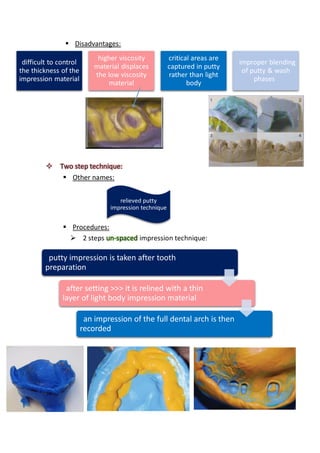 impression techniques for FPD | PDF