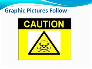 Graphic Pictures Follow
 