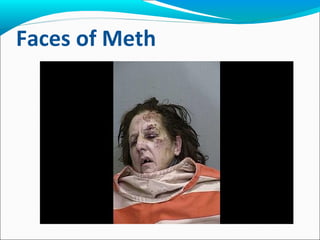 Faces of Meth
 