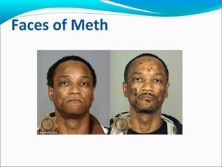 Faces of Meth
 