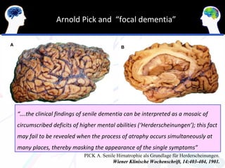 Arnold Pick and “focal dementia”




“….the clinical findings of senile dementia can be interpreted as a mosaic of
circumscribed deficits of higher mental abilities (‘Herderscheinungen’); this fact
may fail to be revealed when the process of atrophy occurs simultaneously at
many places, thereby masking the appearance of the single symptoms”
                           PICK A. Senile Hirnatrophie als Grundlage für Herderscheinungen.
                                        Wiener Klinische Wochenschrift, 14:403-404, 1901.
 