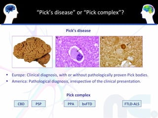 “Pick’s disease” or “Pick complex”?

                                 Pick’s disease




• Europe: Clinical diagnosis, with or without pathologically proven Pick bodies.
• America: Pathological diagnosis, irrespective of the clinical presentation.


                                  Pick complex

      CBD       PSP               PPA     bvFTD                   FTLD-ALS
 