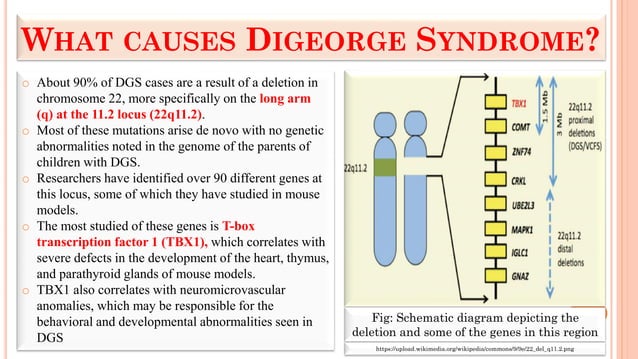 DiGeorge Syndrome (DGS).pdf