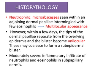 HISTOPATHOLOGY
• Neutrophilic microabscesses seen within an
adjoining dermal papillae intermingled with
few eosinophils Multilocular appearance
• However, within a few days, the tips of the
dermal papillae separate from the overlying
epidermis and the blister become unilocular.
These may coalesce to form a subepidermal
blister.
• Moderately severe inflammatory infiltrate of
neutrophils and eosinophils in subpapillary
dermis.
 