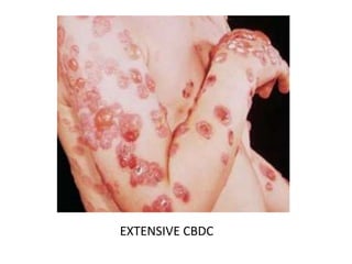 EXTENSIVE CBDC
 