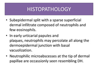 HISTOPATHOLOGY
• Subepidermal split with a sparse superficial
dermal infiltrate composed of neutrophils and
few eosinophils.
• In early urticarial papules and
plaques, neutrophils may percolate all along the
dermoepidermal junction with basal
vacuolization.
• Neutrophilic microabscesses at the tip of dermal
papillae are occassionly seen resembling DH.
 