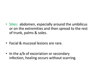 • Sites: abdomen, especially around the umbilicus
or on the extremities and then spread to the rest
of trunk, palms & soles.
• Facial & mucosal lesions are rare.
• In the a/b of excoriation or secondary
infection, healing occurs without scarring.
 