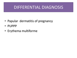 DIFFERENTIAL DIAGNOSIS
• Papular dermatitis of pregnancy
• PUPPP
• Erythema multiforme
 