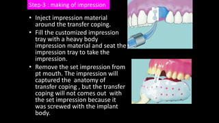 prosthetic concepts in implant dentistry | PPTX
