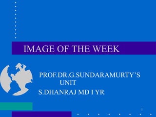 IMAGE OF THE WEEK PROF.DR.G.SUNDARAMURTY’S UNIT  S.DHANRAJ MD I YR  