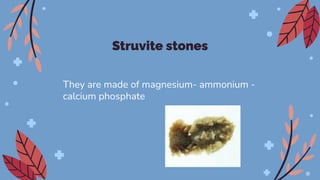 Struvite stones
They are made of magnesium- ammonium -
calcium phosphate
 