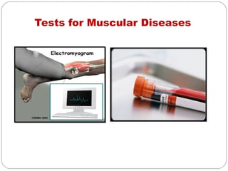 Tests for Muscular Diseases
 