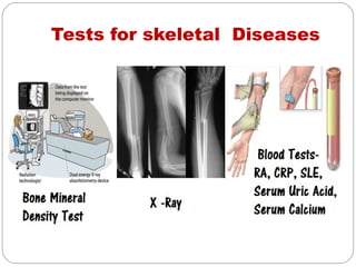 Tests for skeletal Diseases
 