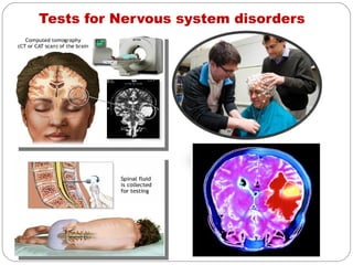 Tests for Nervous system disorders
 