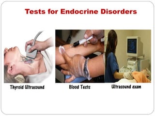 Tests for Endocrine Disorders
 