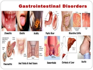 Gastrointestinal Disorders
 