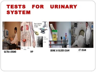 TESTS FOR   URINARY
SYSTEM
 