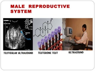 MALE REPRODUCTIVE
SYSTEM
 