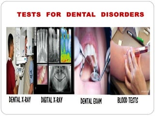 TESTS FOR DENTAL DISORDERS
 