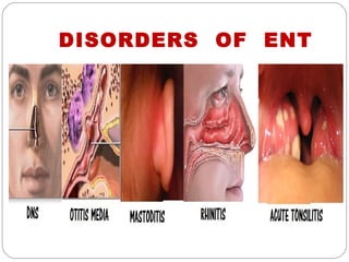 DISORDERS OF ENT
 