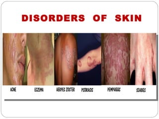 DISORDERS OF SKIN
 