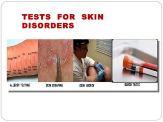 TESTS FOR SKIN
DISORDERS
 