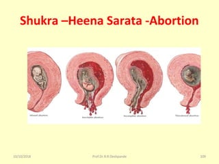 Shukra –Heena Sarata -Abortion
10/10/2018 Prof.Dr.R.R.Deshpande 109
 