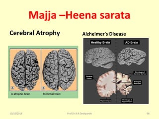 Majja –Heena sarata
Cerebral Atrophy Alzheimer's Disease
10/10/2018 Prof.Dr.R.R.Deshpande 98
 