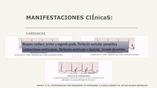 MANIFESTACIONES ClÍnicaS:
CARDIACAS
UNWIN R. ET AL. PATHOPHISIOLOGY AND MANAGEMENT OF HYPOKALEMIA: A CLINICAL PERSPECTIVE. NATURE REVIEWS NEPHROLOGY.
 